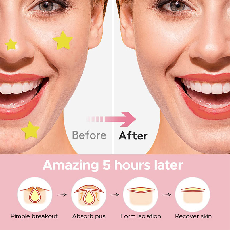600 PCS/Set Star Pimple Patch  - Makeup Beauty Set ulasan dan harga